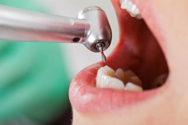 Best Emergency Dental Care for Abscessed Tooth in Lewiston, ME